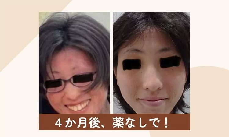 体験者の声1