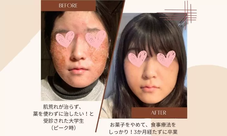 体験者の声2
