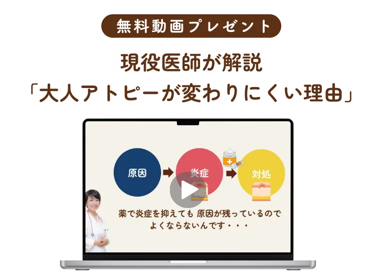 現役医師が解説 大人アトピーが変わりにくい理由